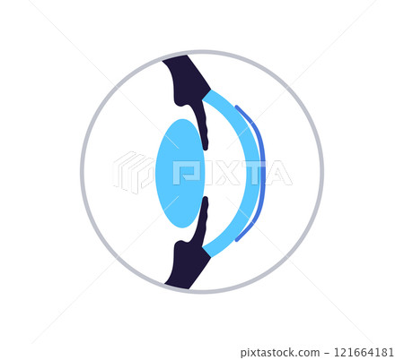 Orthokeratology contact lens Orthokeratology contact lens 121664181