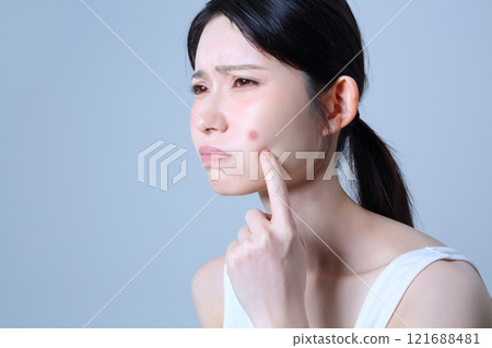 Image of a woman suffering from acne 121688481