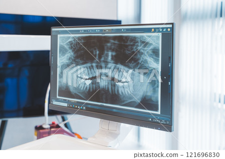 牙齒X射線照片 121696830