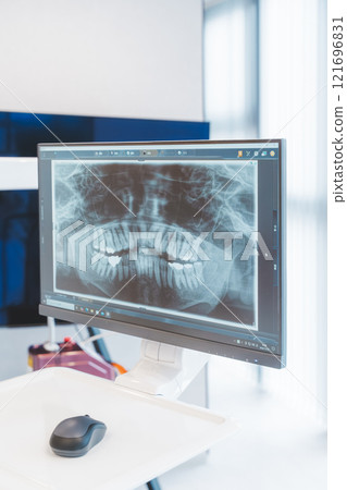 Tooth X-ray Photo 121696831