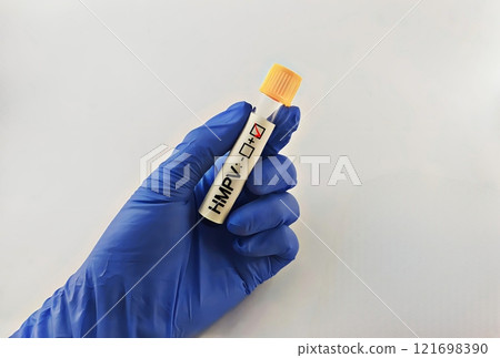 Human Metapneumovirus (HMPV) positive test ,Medical health concept Human Metapneumovirus (HMPV) positive test ,Medical health concept 121698390