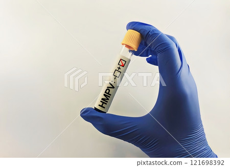 Human Metapneumovirus (HMPV) positive test ,Medical health concept 121698392