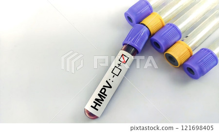 Human Metapneumovirus (HMPV) blood test  121698405