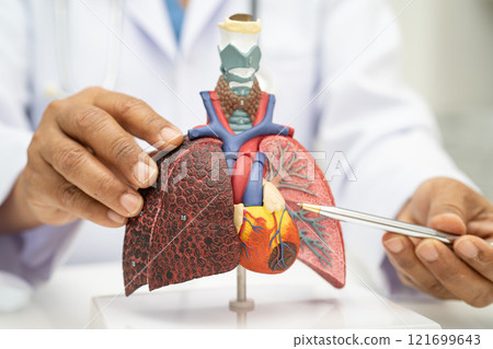 Pneumonia, lung cancer, Asian doctor holding human anatomy model for study diagnosis and treatment in hospital. Pneumonia, lung cancer, Asian doctor holding human anatomy model for study diagnosis and treatment in hospital. 121699643