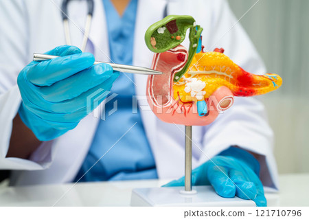 Pancreatitis, pancreatic cancer, Asian doctor with pancreas, gallbladder and bile duct human anatomy model at hospital. 121710796