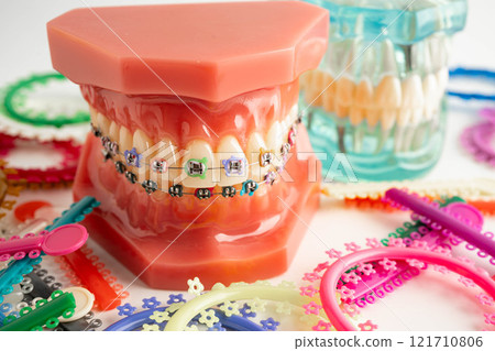 Orthodontic ligatures rings and ties, elastic rubber bands on orthodontic braces, model for dentist studying about dentistry. 121710806