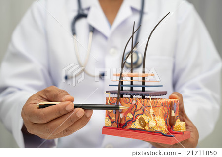 Hair transplant, Asian dermatologist doctor holding skin structure anatomy model for treatment in hospital. 121711050