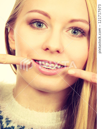 Happy woman showing her braces on teeth 121717973