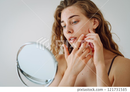 Curly woman touches red inflammations on her face while looking in the mirror in a bright room. 121731585