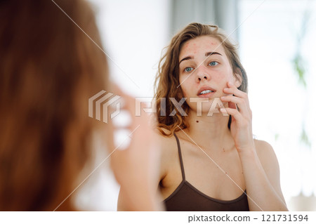 Beautiful woman touches her inflammation on her face while looking in the mirror in a bright room. Beautiful woman touches her inflammation on her face while looking in the mirror in a bright room. 121731594