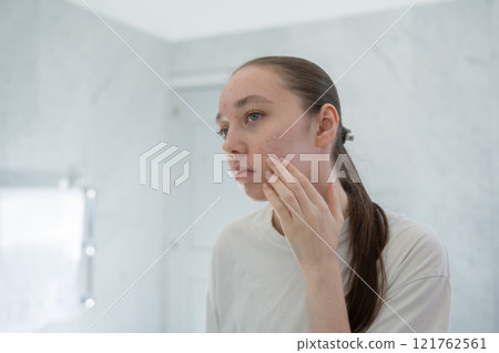 Gen z woman looking at her acne on the cheek, stands before a mirror in bathroom touching her skin. Concept of acne treatment, skincare, adult acne 121762561