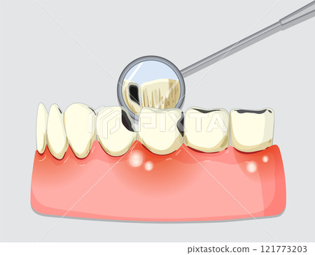 Dental Checkup with Mirror Tool 121773203