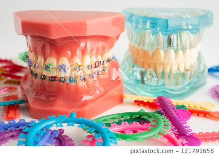 Orthodontic ligatures rings and ties, elastic rubber bands on orthodontic braces, model for dentist studying about dentistry. 121791658