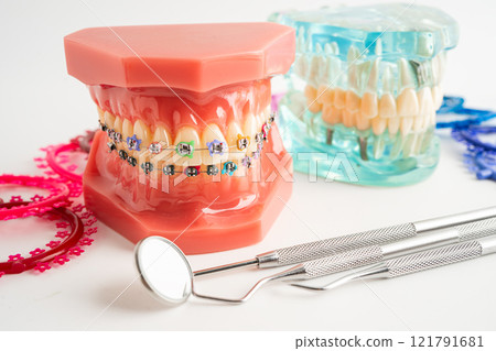 Orthodontic ligatures rings and ties, elastic rubber bands on orthodontic braces, model for dentist studying about dentistry. Orthodontic ligatures rings and ties, elastic rubber bands on orthodontic braces, model for dentist studying about dentistry. 121791681