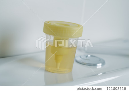 container with a urine sample on the cistern 121808316