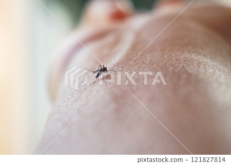 A closeup image of a mosquito feeding on a human hand in natural light for photography A closeup image of a mosquito feeding on a human hand in natural light for photography 121827814