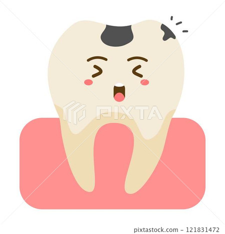 teeth plaque and caries holes 121831472