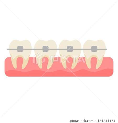 teeth set with metal braces teeth set with metal braces 121831473