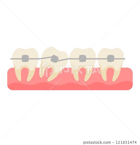 teeth with braces orthodontic dentistry 121831474