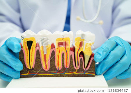 Dentist holding dental implant, artificial tooth roots into jaw, root canal of dental treatment, gum disease, teeth model for dentist. Dentist holding dental implant, artificial tooth roots into jaw, root canal of dental treatment, gum disease, teeth model for dentist. 121834487