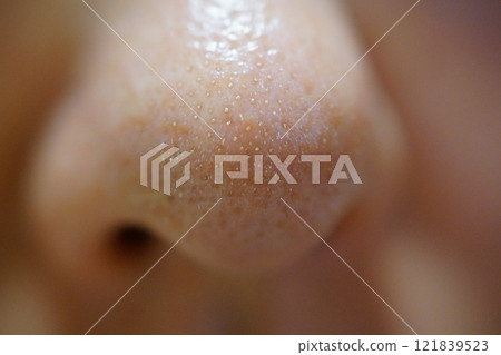 Close-up of nose pores clogged with white keratin plugs 121839523