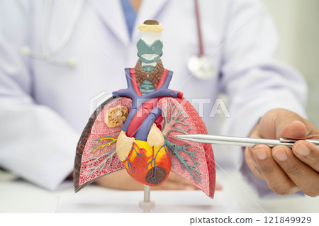 Pneumonia, lung cancer, Asian doctor holding human anatomy model for study diagnosis and treatment in hospital. 121849929