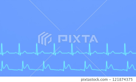 ECG comparison of the normal heart rhythm of a healthy patient and the ECG of a patient with myocardial infarction. 121874375