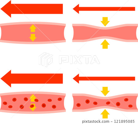 Deformed illustration of blood vessel expansion and contraction 121895085
