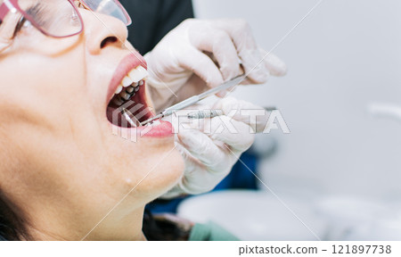 Close up of patient checked by dentist, Dentist checking patient's mouth, close up of dentist's hands checking patient's mouth, Dentist performing stomatology Close up of patient checked by dentist, Dentist checking patient's mouth, close up of dentist's hands checking patient's mouth, Dentist performing stomatology 121897738