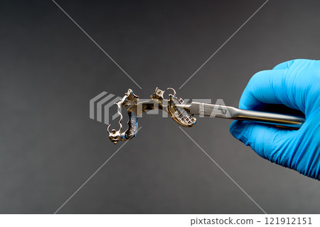 A person in blue gloves holds scissors in the picture 121912151