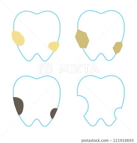 一組蛀牙的過程 121918693