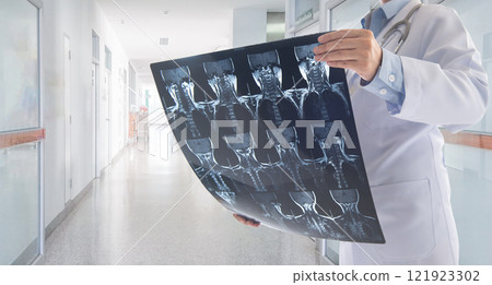 doctor cervical spine x-ray film 121923302