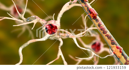 Astrocyte and blood vessel Astrocyte and blood vessel 121933159