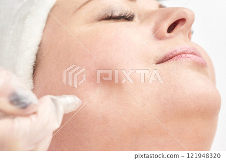 Female receiving cosmetic treatment with needle on cheek close up 121948320