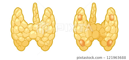 Illustration of the thyroid gland and parathyroid gland Illustration of the thyroid gland and parathyroid gland 121963688