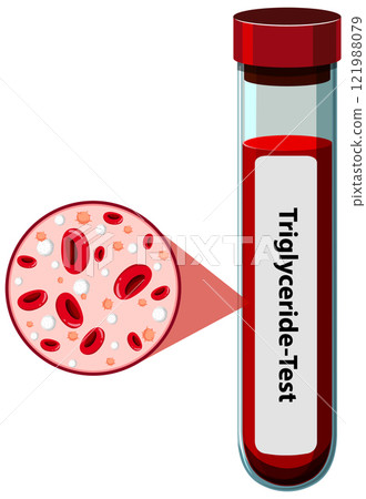 Triglyceride Blood Test Illustration 121988079
