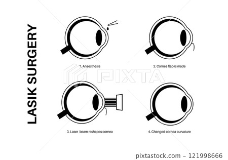 LASIK eye surgery LASIK eye surgery 121998666