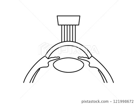 LASIK eye surgery 121998672