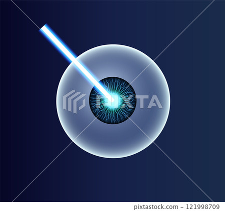 LASIK eye surgery 121998709