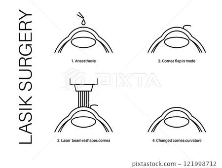 LASIK eye surgery LASIK eye surgery 121998712