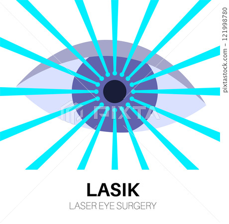 Lasik laser surgery Lasik laser surgery 121998780