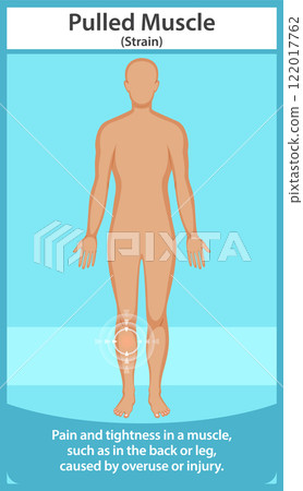 Understanding Muscle Strain and Recovery Understanding Muscle Strain and Recovery 122017762