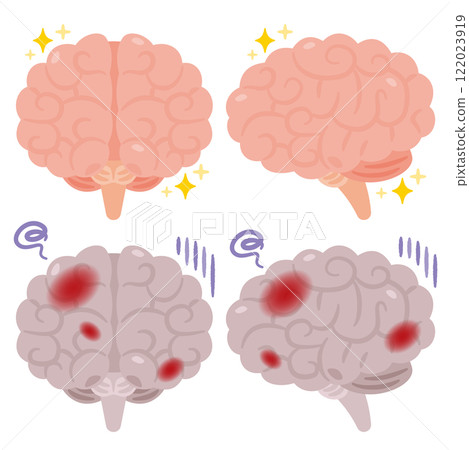 Illustration of a healthy and beautiful brain and an unhealthy brain with inflammation Illustration of a healthy and beautiful brain and an unhealthy brain with inflammation 122023919