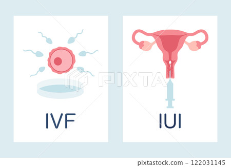 In vitro fertilization IVF and intrauterine insemination IUI infographic posters set. Egg, sperm, uterus and syringe illustration in cartoon flat style. Vector illustration 122031145
