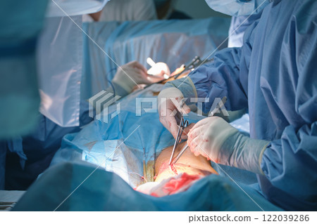 Team of professional doctors operating a patient conducting open cut surgery in surgical room. Healthcare and medical intervention concept 122039286
