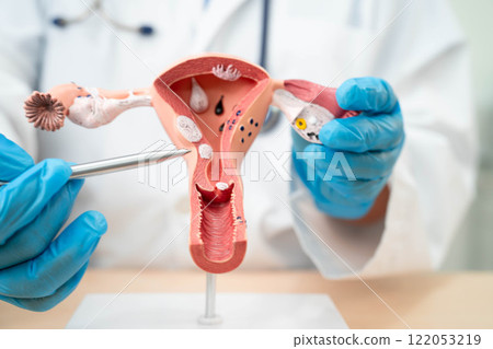 Uterus, doctor holding human anatomy model for study diagnosis and treatment in hospital. Uterus, doctor holding human anatomy model for study diagnosis and treatment in hospital. 122053219