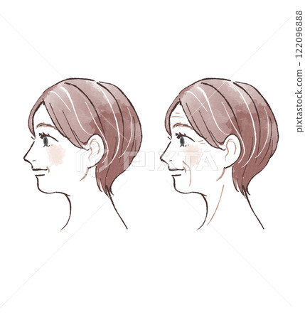 側身女子：有無皺紋 122096888
