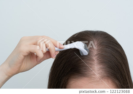 Close up view of young woman using microneedling derma roller on head for stimulating new hair growth with copy space. Alopecia treatment, scalp stimulation, hair loss and baldness targeted therapy. Close up view of young woman using microneedling derma roller on head for stimulating new hair growth with copy space. Alopecia treatment, scalp stimulation, hair loss and baldness targeted therapy. 122123088