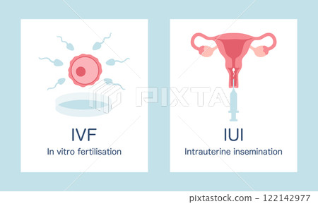 In vitro fertilization IVF and intrauterine insemination IUI infographic posters set. Egg, sperm, uterus and syringe illustration in cartoon flat style. Vector illustration In vitro fertilization IVF and intrauterine insemination IUI infographic posters set. Egg, sperm, uterus and syringe illustration in cartoon flat style. Vector illustration 122142977