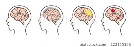 大腦插圖集 122155396